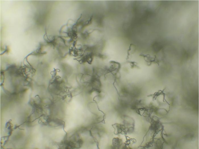 Penicillium expansum konidiofore